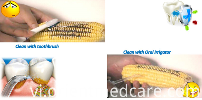 Revolution of oral water flosser Revolution of oral water flosser